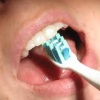 Dantų valymosi optimali trukmė?