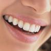 Faktai apie dantų priežiūrą